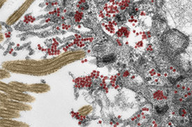 Die elektronenmikroskopische Aufnahme (Ultradünnschnitt, koloriert) zeigt den Ausschnitt einer Zelle in der Riechschleimhaut. 