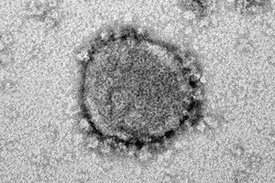 Das neue Coronavirus, SARS-CoV-2, steht im Zentrum zahlreicher Forschungsprojekte des Ulmer Instituts für Molekulare Virologie. Jetzt haben die Forschenden einen vielversprechenden zelleigenen und antiviralen Faktor charakterisiert 