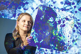 uf dieser Mikroskopaufnahme sind die Tregs rot eingefärbt. DZD-Immunologin Carolin Daniel stellt die regulatorischen T-Zellen in den Fokus ihrer wissenschaftlichen Arbeit.