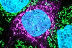 Das Virusbestandteil Orf9b (pink) bindet an das Wirtsprotein TOM70 (grün). Dieses Molekül an den Mitochondrien der befallenen Zellen wird vom Virus beeinflusst, fand ein internationales Konsortium heraus. TOM70 spielt eine Rolle in der antiviralen Antwort