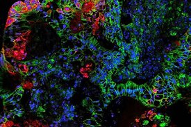 Für diese SARS-CoV-2-Studie wurden Darm-Organoide infiziert. Auf der fluoreszenzmikroskopischen Aufnahme dargestellt ist ein gefärbter Schnitt. Zu erkennen sind rot das Spike Protein in den infizierten Zellen, grün E-Cadherin und blau die Zellkerne (Aufna