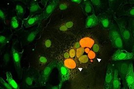 Mikroskopische Aufnahme durch Spikeprotein verschmolzene Zellen. Pfeile zeigen auf eine Zusammenlagerung von Zellkernen (orange) mehrerer verschmolzener Zellen. 